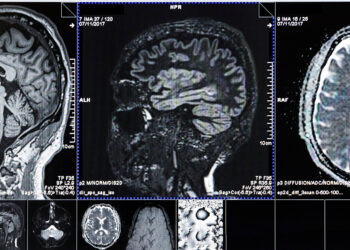 Neurosurgery and Spine